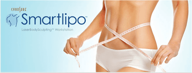 Lazer Liposuction